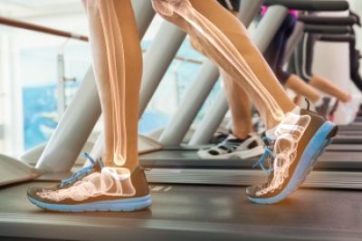 Common Foot Injuries From Treadmill Use