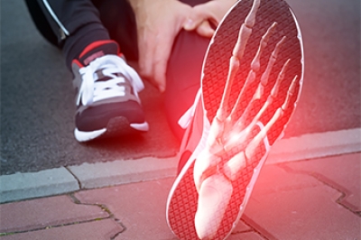Risk of Foot Stress Fractures in Runners